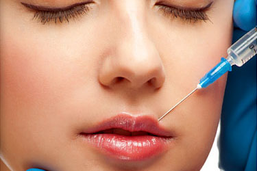 Hyaluronan and hyaluronic fillers